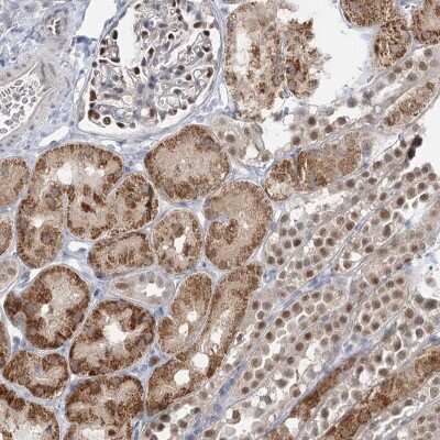 Immunohistochemistry: ADK Antibody [NBP2-38410] - Staining of human kidney shows strong cytoplasmic and nuclear positivity in cells in tubules.