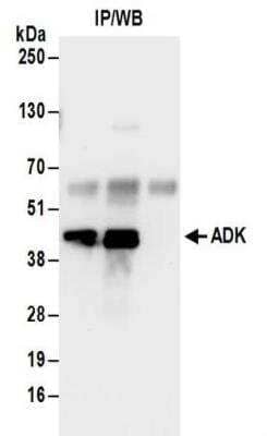 Immunoprecipitation: ADK Antibody [NBP2-32189] - Samples:  Whole cell lysate (0.5 or 1.0 mg per IP reaction; 20% of IP loaded) from 293T cells. Antibodies:  Affinity purified rabbit anti-Adenosine Kinase antibody NBP2-32189 used for IP at 6 ug per reaction.  Adenosine Kinase was also immunoprecipitated by rabbit anti-Adenosine Kinase antibody BL15848.  For blotting immunoprecipitated Adenosine Kinase, NBP2-32189 was used at 1 ug/ml.  Detection: Chemiluminescence with an exposure time of 30 seconds.