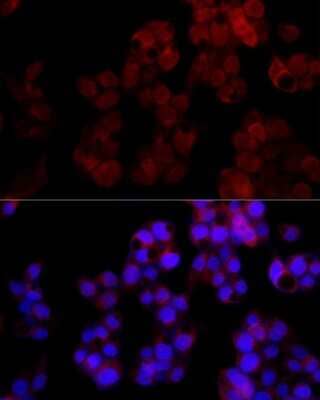 Immunocytochemistry/Immunofluorescence: ADP-Sugar Pyrophosphatase/NUDT5 Antibody (7Y9M2) [NBP3-15284] - Immunofluorescence analysis of HepG2 cells using ADP-Sugar Pyrophosphatase/NUDT5 Rabbit mAb (NBP3-15284) at dilution of 1:100 (40x lens). Blue: DAPI for nuclear staining.