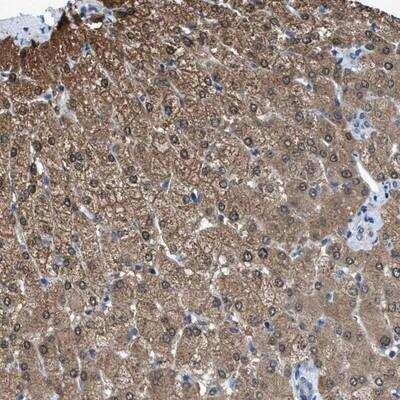 Immunohistochemistry-Paraffin: ADP-Sugar Pyrophosphatase/NUDT5 Antibody [NBP1-83131] - Staining of human liver shows moderate cytoplasmic positivity in hepatocytes.