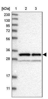 Western Blot: ADP-Sugar Pyrophosphatase/NUDT5 Antibody [NBP1-83131] - Lane 1: Marker  (kDa) 230, 130, 95, 72, 56, 36, 28, 17, 11.  Lane 2: Human cell line RT-4.  Lane 3: Human cell line U-251MG sp