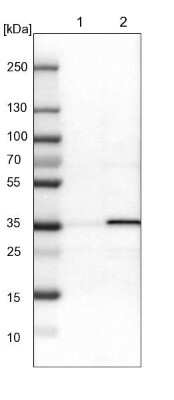 Western Blot: ADP-Sugar Pyrophosphatase/NUDT5 Antibody [NBP1-83131] - Lane 1: NIH-3T3 cell lysate (Mouse embryonic fibroblast cells). Lane 2: NBT-II cell lysate (Rat Wistar bladder tumor cells).