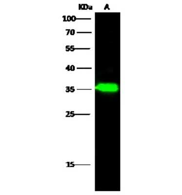 Western Blot: ADP-Sugar Pyrophosphatase/NUDT5 Antibody [NBP3-00064] - Anti-ADP-Sugar Pyrophosphatase/NUDT5 rabbit polyclonal antibody at 1:500 dilution. Lane A: ADP-Sugar Pyrophosphatase/NUDT5 knockout Hela Whole Cell Lysate. Lane B: Hela Whole Cell Lysate. Lysates/proteins at 10 ug per lane. Secondary Goat Anti-Rabbit IgG (H+L)/HRP at 1/10000 dilution. Developed using the ECL technique. Performed under reducing conditions. Predicted band size: 24 kDa. Observed band size: 35 kDa