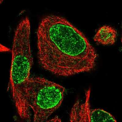 Immunocytochemistry/Immunofluorescence: ADP-ribosylarginine hydrolase Antibody [NBP2-55160] - Staining of human cell line PC-3 shows localization to nucleus & nuclear membrane.