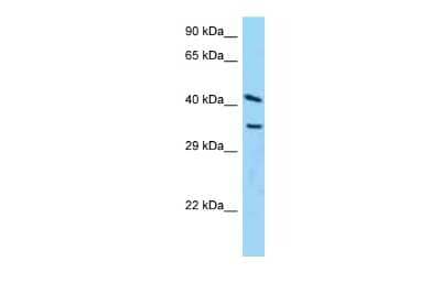 Western Blot: ADP-ribosylarginine hydrolase Antibody [NBP2-84402] - WB Suggested Anti-ADPRH Antibody. Titration: 1.0 ug/ml. Positive Control: Hela Whole Cell