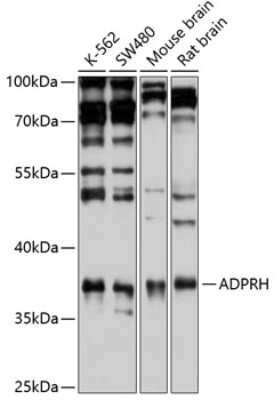 Western Blot: ADP-ribosylarginine hydrolase Antibody [NBP2-92469] - Analysis of extracts of various cell lines, using ADP-ribosylarginine hydrolase at 1:1000 dilution.Secondary antibody: HRP Goat Anti-Rabbit IgG (H+L) at 1:10000 dilution.Lysates/proteins: 25ug per lane.Blocking buffer: 3% nonfat dry milk in TBST.Detection: ECL Basic Kit .Exposure time: 15s.