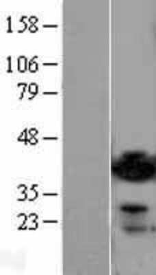 Western Blot ADP-ribosylarginine hydrolase Overexpression Lysate