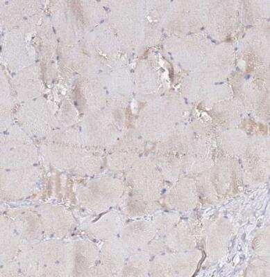Immunohistochemistry-Paraffin: ADPGK Antibody [NBP1-91653] - Staining of human skeletal muscle shows no positivity in myocytes as expected.