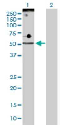 Western Blot: ADPGK Antibody [H00083440-D01P] - Analysis of ADPGK expression in transfected 293T cell line by ADPGK polyclonal antibody.Lane 1: ADPGK transfected lysate(54.10 KDa).Lane 2: Non-transfected lysate.