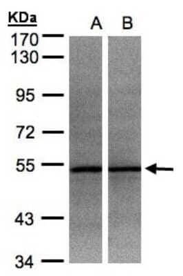 Western Blot: ADPGK Antibody [NBP1-32429] - Sample(30 ug whole cell lysate)A:HeLa S3 7. 5% SDS PAGE, antibody diluted at 1:500.