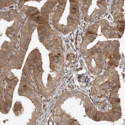 Immunohistochemistry-Paraffin: ADPRHL2 Antibody [NBP1-88834] - Staining of human Fallopian tube shows moderate cytoplasmic positivity in glandular cells.