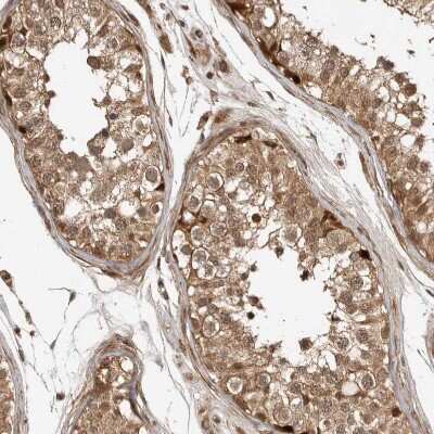 Western Blot: ADPRHL2 Antibody [NBP1-88834] - Staining of human testis shows moderate  cytoplasmic and nuclear positivity in cells in seminiferous ducts.