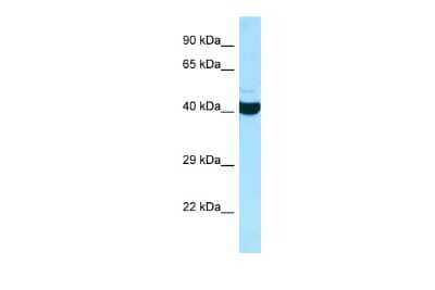 Western Blot: ADPRHL2 Antibody [NBP2-84401] - WB Suggested Anti-ADPRHL2 Antibody. Titration: 1.0 ug/ml. Positive Control: HepG2 Whole Cell