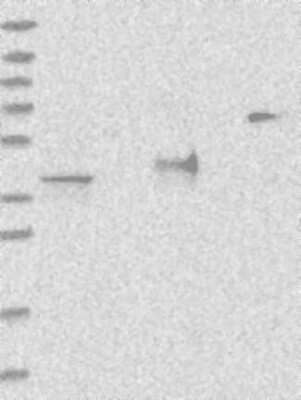 Western Blot: ADPRHL2 Antibody [NBP3-17334] - Lane 1: Marker [kDa] 230, 130, 95, 72, 56, 36, 28, 17, 11;   Lane 2: RT4;   Lane 3: U-251 MG;   Lane 4: Human Plasma;   Lane 5: Liver;   Lane 6: Tonsil