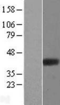 Western Blot: ADPRHL2 Overexpression Lysate (Adult Normal) [NBL1-07356] Left-Empty vector transfected control cell lysate (HEK293 cell lysate); Right -Over-expression Lysate for ADPRHL2.