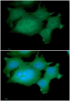 Immunocytochemistry/Immunofluorescence: ADRM1 Antibody (34C2) [NBP2-59402] - Analysis of ADRM1 in MCF7 cells line, stained with DAPI (Blue) for nucleus staining and monoclonal anti-human   ADRM1 antibody (1:100) with goat anti-mouse IgG-Alexa fluor 488 conjugate (Green).