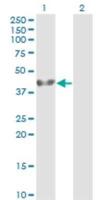 Western Blot: ADRM1 Antibody (3C6) [H00011047-M01] - Analysis of ADRM1 expression in transfected 293T cell line by ADRM1 monoclonal antibody (M01), clone 3C6.Lane 1: ADRM1 transfected lysate(42.2 KDa).Lane 2: Non-transfected lysate.