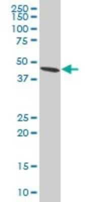 Western Blot: ADRM1 Antibody (3D11) [H00011047-M02] - ADRM1 monoclonal antibody (M02), clone 3D11. Analysis of ADRM1 expression in HeLa.