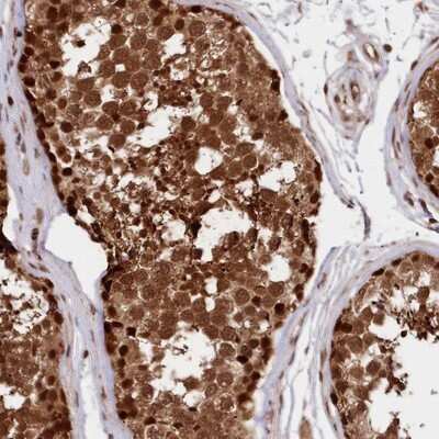 Immunohistochemistry-Paraffin: ADRM1 Antibody [NBP1-88993] - Staining of human testis shows strong nuclear and cytoplasmic positivity in cells in seminiferus ducts.