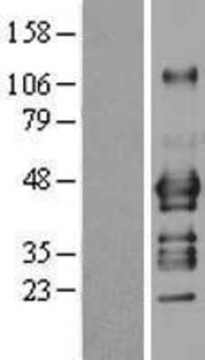 Western Blot: ADRM1 Overexpression Lysate (Adult Normal) [NBL1-07361] Left-Empty vector transfected control cell lysate (HEK293 cell lysate); Right -Over-expression Lysate for ADRM1.