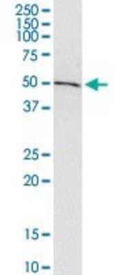 Western Blot: ADSSL1 Antibody (2D12) [H00122622-M01] - ADSSL1 monoclonal antibody (M01), clone 2D12. Analysis of ADSSL1 expression in A-431.