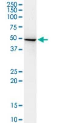 ADSSL1 Antibody (2D12) (H00122622-M01): Novus Biologicals