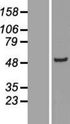 Western Blot: ADSSL1 Overexpression Lysate (Adult Normal) [NBL1-07365] Left-Empty vector transfected control cell lysate (HEK293 cell lysate); Right -Over-expression Lysate for ADSSL1.