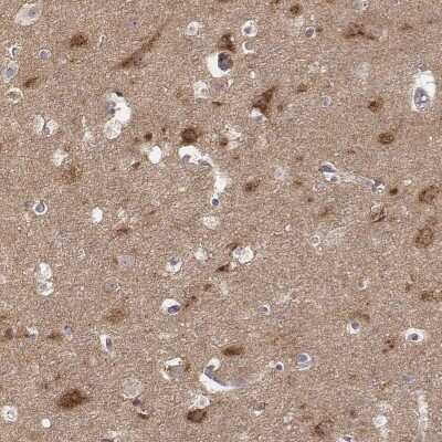 <b>Independent Antibodies Validation. </b>Immunohistochemistry-Paraffin: ADTB1 Antibody [NBP2-57886] - Immunohistochemical staining of human cerebral cortex shows strong cytoplasmic positivity in neuronal cells.