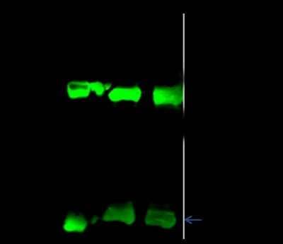 Immunoprecipitation: ADTB1 Antibody [NBP2-99079] - ADTB1 was immunoprecipitated using: Lane A: 0.5 mg NIH-3T3 Whole Cell Lysate. Lane B: 0.5 mg K562 Whole Cell Lysate. Lane C: 0.5 mg Hela Whole Cell Lysate. 1 ul anti-ADTB1 rabbit polyclonal antibody and 15 ul of 50 % Protein G agarose. Primary antibody: Anti-ADTB1 rabbit polyclonal antibody, at 1:500 dilution. Secondary antibody: Dylight 800-labeled antibody to rabbit IgG (H+L), at 1:5000 dilution. Developed using the Odyssey technique. Performed under reducing conditions. Predicted band size: 105 kDa. Observed band size: 112 kDa