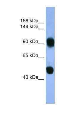 Western Blot: ADTB1 Antibody [NBP1-68947] - ADTB1 Antibody Human Muscle lysate, concentration 0.2-1 ug/ml.