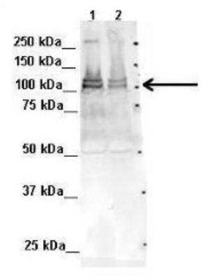 Western Blot: ADTB1 Antibody [NBP1-68947] - ADTB1 Antibody Mouse WT brain and Rat brain, concentration 2ug/ml.