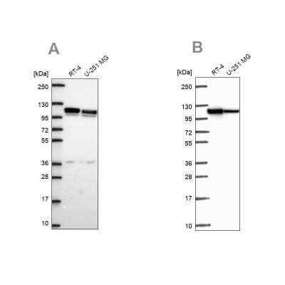 Western Blot: ADTB1 Antibody [NBP2-57886] - Analysis using Anti-AP1B1 antibody NBP2-57886 (A) shows similar pattern to independent antibody NBP2-57109 (B).