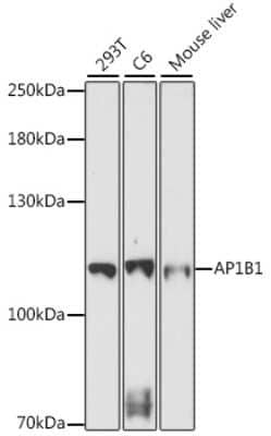 Western Blot: ADTB1 Antibody [NBP2-92312] - Analysis of extracts of various cell lines, using ADTB1 at 1:1000 dilution.Secondary antibody: HRP Goat Anti-Rabbit IgG (H+L) at 1:10000 dilution.Lysates/proteins: 25ug per lane.Blocking buffer: 3% nonfat dry milk in TBST.Detection: ECL Basic Kit .Exposure time: 5min.