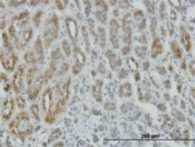 Immunohistochemistry-Paraffin: AE Binding Protein 1/ACLP Antibody (1D2) [H00000165-M01] - Analysis of monoclonal antibody to AEBP1 on formalin-fixed paraffin-embedded human adrenal gland. Antibody concentration 3 ug/ml.