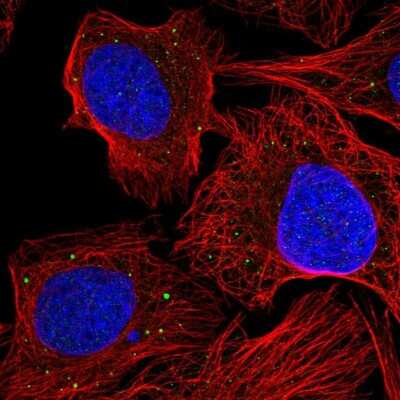 Immunocytochemistry/Immunofluorescence: AE Binding Protein 1/ACLP Antibody [NBP2-55784] - Staining of human cell line U-2 OS shows localization to vesicles.