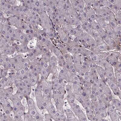 Immunohistochemistry-Paraffin: AE Binding Protein 1/ACLP Antibody [NBP2-49432] - Staining of human liver shows low expression as expected.