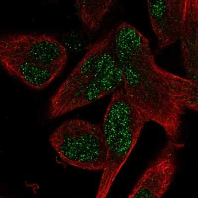 Immunocytochemistry/Immunofluorescence: AEBP2 Antibody [NBP2-30712] - Immunofluorescent staining of human cell line RH-30 shows localization to nucleus.