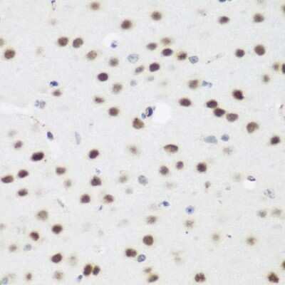 Immunohistochemistry-Paraffin: AEBP2 Antibody [NBP2-92913] - Paraffin-embedded mouse brain using AEBP2 .