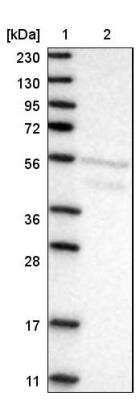 Western Blot: AEBP2 Antibody [NBP2-30712] - Lane 1: Marker  [kDa] 230, 130, 95, 72, 56, 36, 28, 17, 11  Lane 2: Human cell line RT-4