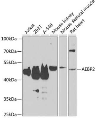 Western Blot: AEBP2 Antibody [NBP2-92913] - Analysis of extracts of various cell lines, using AEBP2 .Exposure time: 90s.