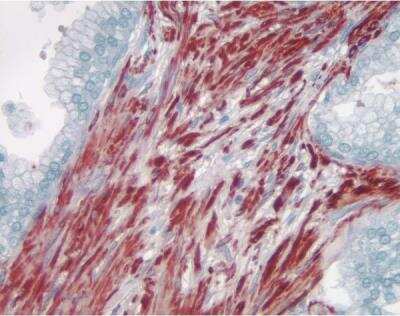 AEC Substrate Kit [SK-4200-NB] - Prostate: Smooth muscle actin (m), ImmPRESS anti-mouse Ig Kit, AEC substrate kit (red). Hematoxylin QS counterstain (blue). Mounted in VectaMount AQ Mounting Medium.