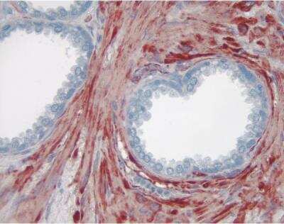 AEC Substrate Kit [SK-4200-NB] - Prostate: Smooth muscle actin (m), ImmPRESS anti-mouse Ig Kit, AEC substrate kit (red). Hematoxylin QS counterstain (blue). Mounted in VectaMount AQ Mounting Medium.