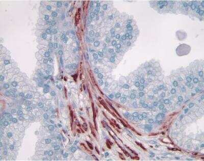 AEC Substrate Kit [SK-4200-NB] - Prostate: Smooth muscle actin (m), ImmPRESS anti-mouse Ig Kit, AEC substrate kit (red). Hematoxylin QS counterstain (blue). Mounted in VectaMount AQ Mounting Medium.