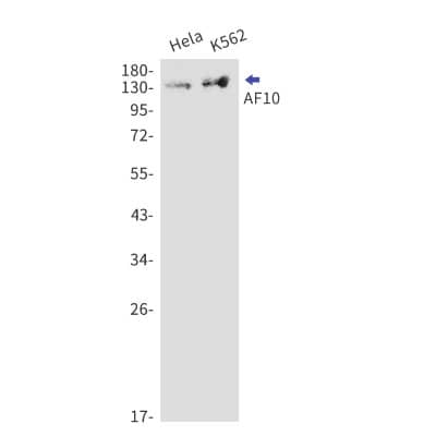 Western Blot: AF10 Antibody (S07-2G2) [NBP3-19560] - Western blot detection of AF10 in Hela, K562 cell lysates using NBP3-19560 (1:1000 diluted). Predicted band size: 113kDa. Observed band size: 140kDa.