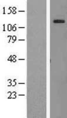 Western Blot: AF10 Overexpression Lysate (Adult Normal) [NBL1-13135] Left-Empty vector transfected control cell lysate (HEK293 cell lysate); Right -Over-expression Lysate for AF10.