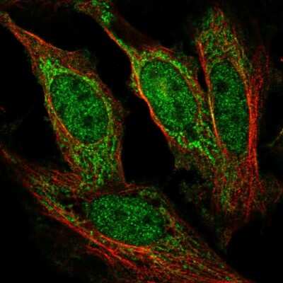 Immunocytochemistry/ Immunofluorescence AF4 Antibody