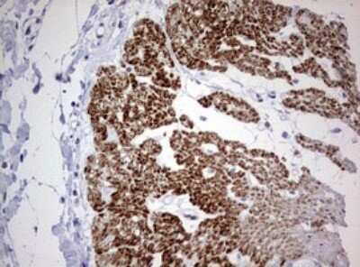 Immunohistochemistry: AFAP Antibody (2G9) [NBP2-46498] - Analysis of Human colon tissue. (Heat-induced epitope retrieval by 10mM citric buffer, pH6.0, 120C for 3min)