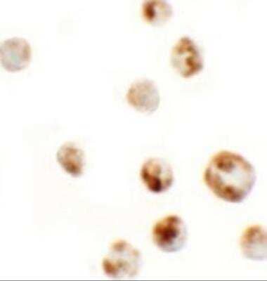 Immunocytochemistry/Immunofluorescence: AFAP1L1 Antibody [NBP2-81889] - Analysis of AFAP1L1 in A549 cells with AFAP1L1 antibody at 5 ug/ml.