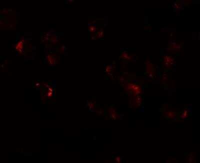 Immunocytochemistry/Immunofluorescence: AFAP1L1 Antibody [NBP2-81889] - Analysis of AFAP1L1 in A549 cells with AFAP1L1 antibody at 20 ug/ml.