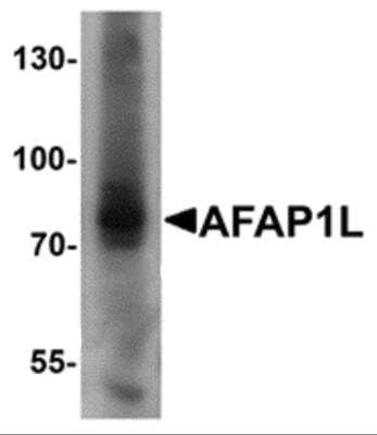 Western Blot: AFAP1L1 Antibody [NBP2-81889] - Analysis of AFAP1L1 in A549 cell lysate with AFAP1L1 antibody at 1 ug/ml.